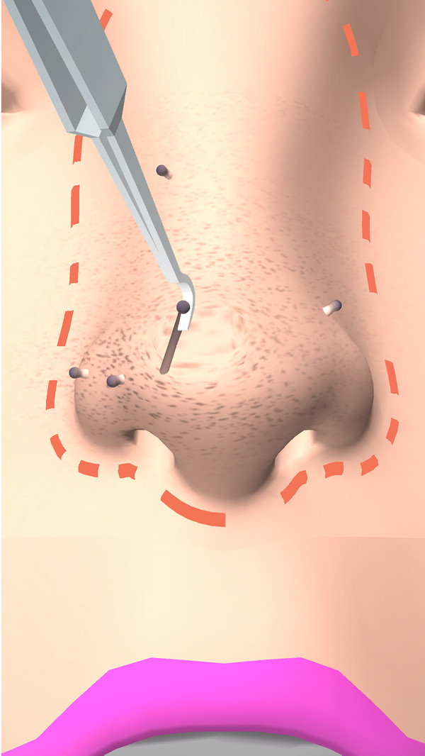 干净的鼻子游戏截图2